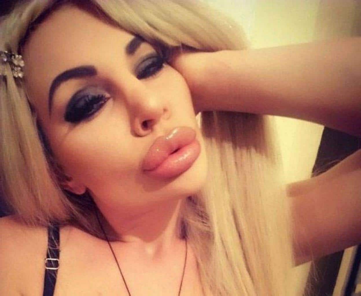 Lips Porn - Crazy HUGE Lips Fail: Girls Who Took Lip Injections A Little ...