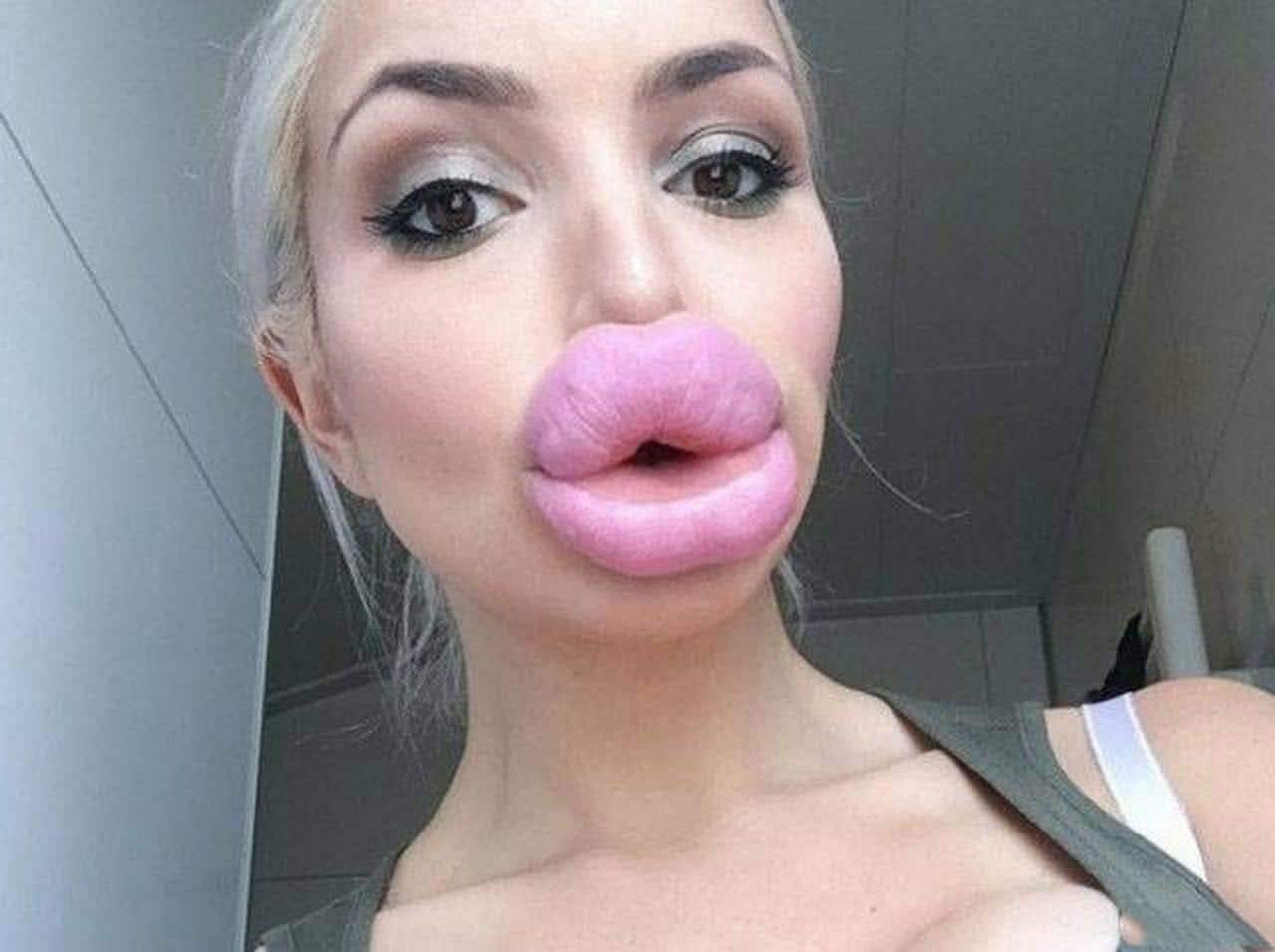 Big Nose Girl Blowjob - Crazy HUGE Lips Fail: Girls Who Took Lip Injections A Little ...