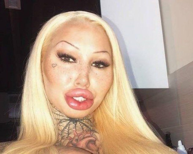 Botox Lips - Crazy Huge Lips Fail: Girls Who Took Lip Injections A Little Too Far